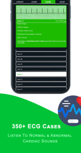 اسکرین شات 2 برنامه ECG Academy | ECG Made Easy