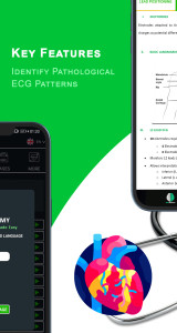 اسکرین شات 5 برنامه ECG Academy | ECG Made Easy
