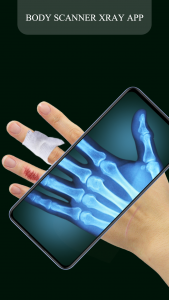 اسکرین شات بازی Xray Camera Scanner Real X Ray 2