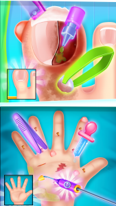 اسکرین شات بازی Pinky toe doctor 1