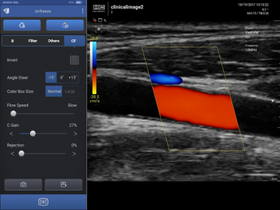 اسکرین شات برنامه SONON Ultrasound App 1