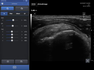 اسکرین شات برنامه SONON Ultrasound App 4