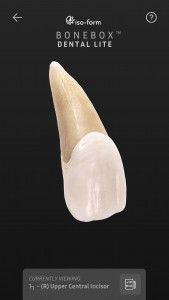 اسکرین شات 3 برنامه BoneBox™ - Dental Lite
