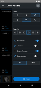 اسکرین شات برنامه IDV - IMAIOS DICOM Viewer 5