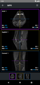 اسکرین شات 4 برنامه IDV - IMAIOS DICOM Viewer