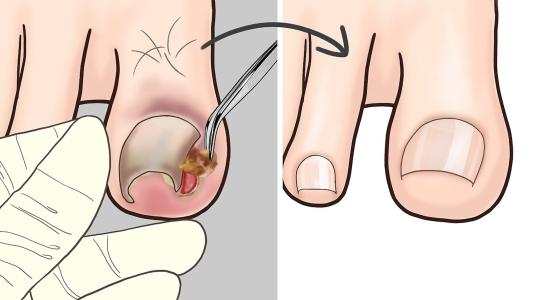 اسکرین شات 1 بازی ASMR Salon Foot Care Makeover