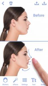 اسکرین شات 1 برنامه Rhinoplasty App: Nose Editor