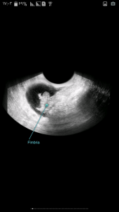 اسکرین شات برنامه بارداری 4