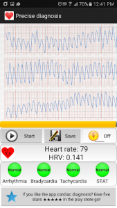 اسکرین شات برنامه Cardiac diagnosis (heart rate, arrhythmia) 3