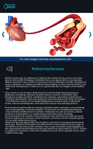 اسکرین شات برنامه Circulatory System Anatomy 4