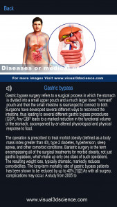 اسکرین شات 5 برنامه Digestive System