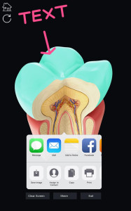 اسکرین شات 8 برنامه Dental Anatomy Pro.