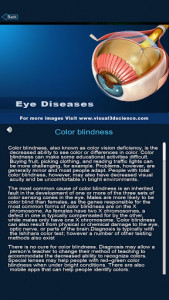 اسکرین شات برنامه Eye Anatomy Pro. 5