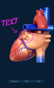 اسکرین شات 6 برنامه Heart Anatomy Pro.