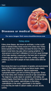 اسکرین شات برنامه Kidney Anatomy Pro. 8