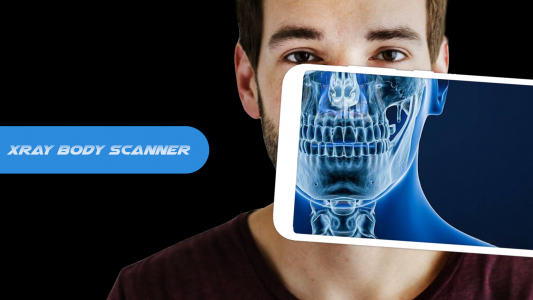 اسکرین شات بازی X ray Body Scanner Xray camera 2