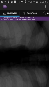 اسکرین شات 6 برنامه Mobile Dicom Viewer