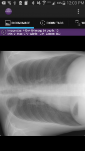 اسکرین شات 2 برنامه Mobile Dicom Viewer