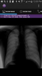 اسکرین شات 4 برنامه Mobile Dicom Viewer