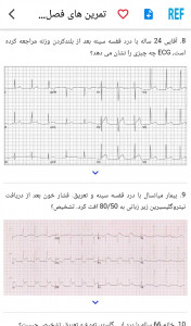 اسکرین شات برنامه مرور نوار قلب ECG review 10