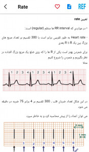 اسکرین شات برنامه مرور نوار قلب ECG review 6
