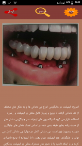 اسکرین شات برنامه قالبگیری دندان(1) 5
