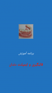 اسکرین شات برنامه قالبگیری دندان(1) 1