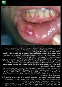 اسکرین شات برنامه بیماری های دهان 1