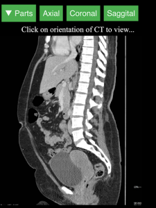 اسکرین شات برنامه Radiology CT Viewer 8