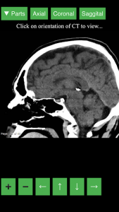 اسکرین شات برنامه Radiology CT Viewer 2