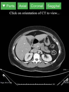 اسکرین شات برنامه Radiology CT Viewer 6