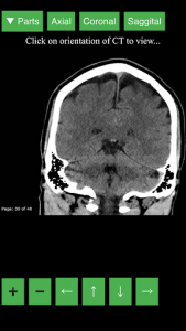 اسکرین شات برنامه Radiology CT Viewer 3