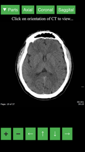 اسکرین شات برنامه Radiology CT Viewer 1