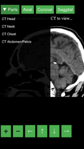 اسکرین شات برنامه Radiology CT Viewer 4