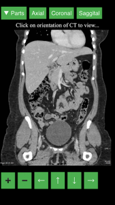 اسکرین شات برنامه Radiology CT Viewer 5