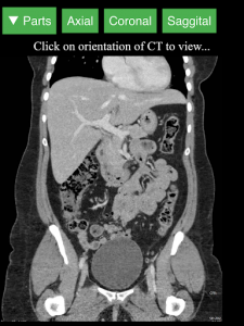 اسکرین شات برنامه Radiology CT Viewer 7