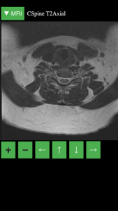 اسکرین شات برنامه MRI Viewer 4