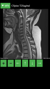 اسکرین شات برنامه MRI Viewer 3