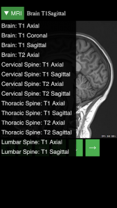 اسکرین شات برنامه MRI Viewer 5