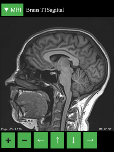 اسکرین شات برنامه MRI Viewer 7