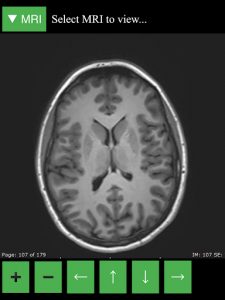 اسکرین شات برنامه MRI Viewer 6