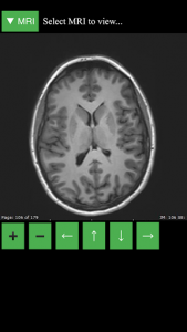 اسکرین شات برنامه MRI Viewer 1