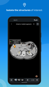 اسکرین شات 4 برنامه IMAIOS e-Anatomy