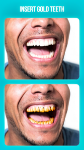 اسکرین شات برنامه Dentist Photo Editor 2