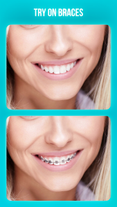 اسکرین شات 3 برنامه Dentist - editor