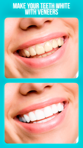 اسکرین شات 1 برنامه Dentist - editor