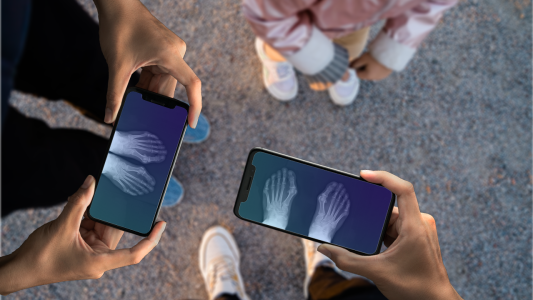 اسکرین شات 3 برنامه Xray scan filter cam